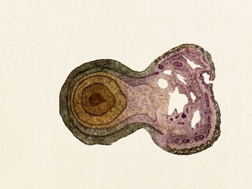 مرض سلّ الزيتون ولاّ "جرب الزيتون" (Pseudomonas) : تاريخ المرض وطرق الحماية والعلاج العصري